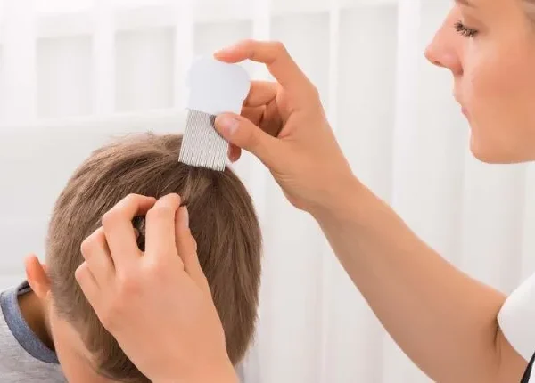 Head Lice Removal Boca